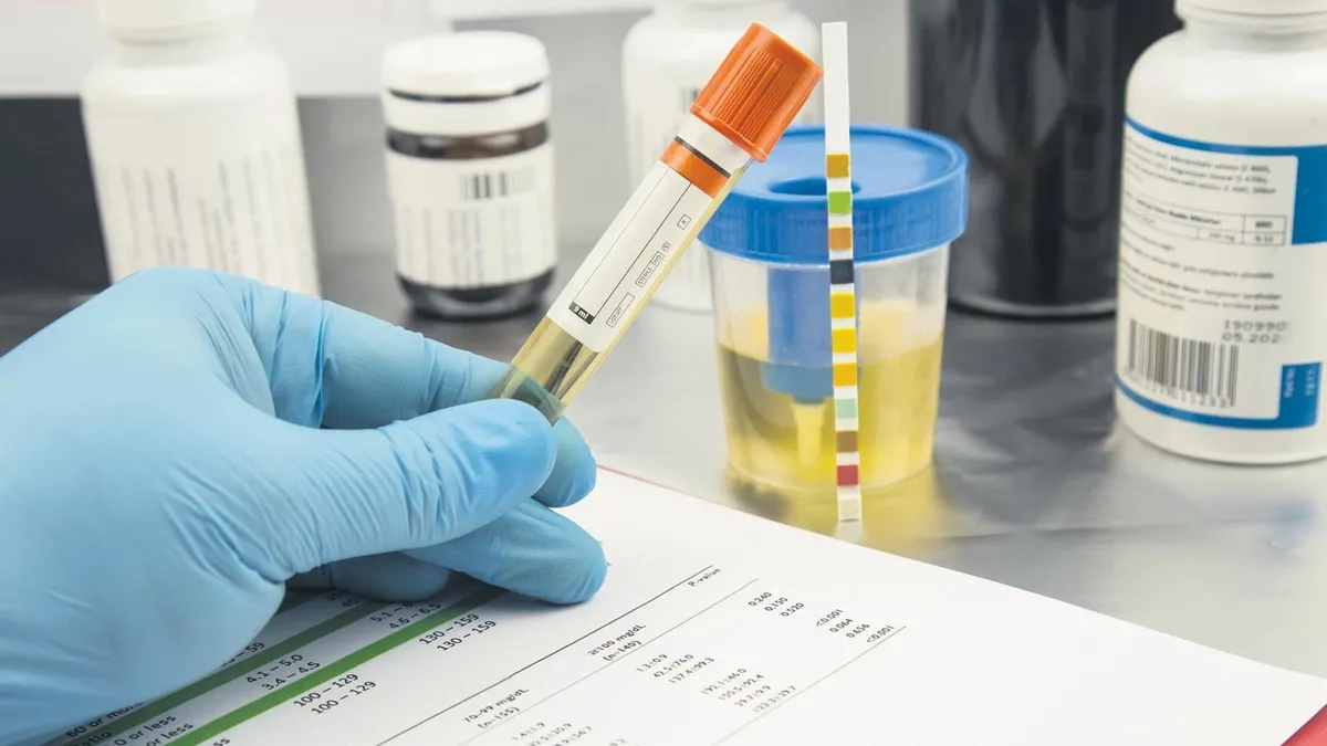 Türkiye'de İşe Alımlarda Uyuşturucu Testi Dönemi: Stratejik Sektörlerde Yeni Standart